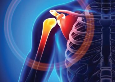 Травми та захворювання плечового суглоба: причини, симптоми та лікування